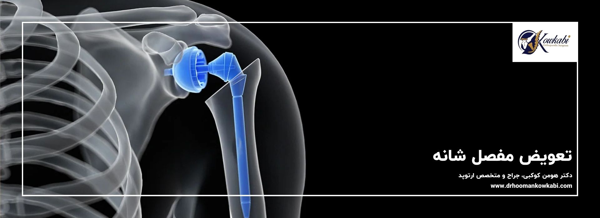 بهترین دکتر تعویض مفصل شانه