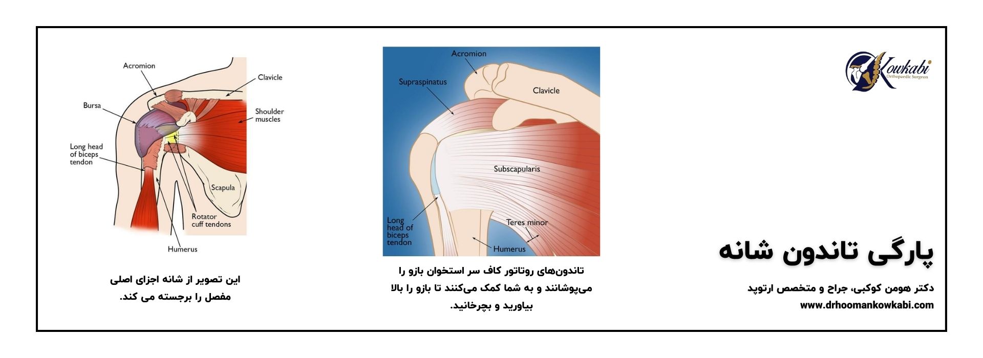 آناتومی تاندون های شانه و روتاتور کاف