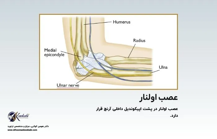 سندرم تونل کوبیتال