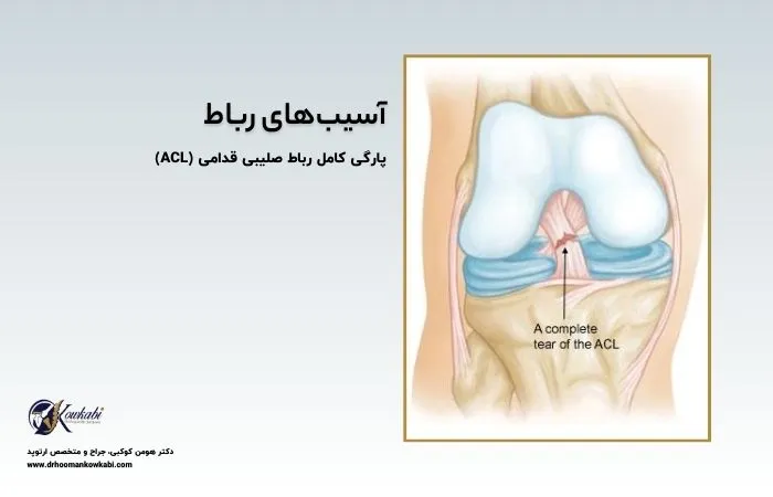 صدا دادن زانو