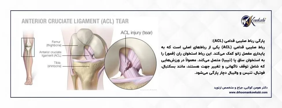 آب آوردن زانو