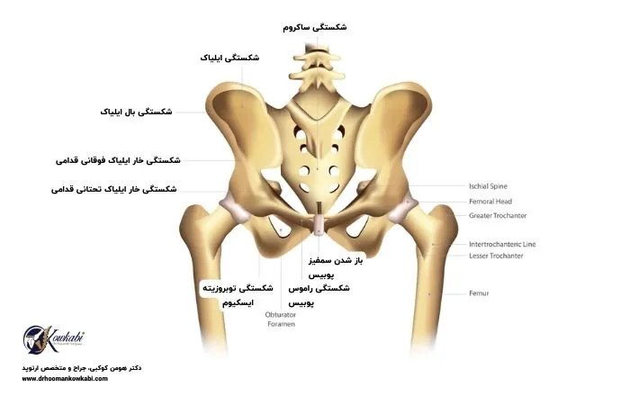 بهترین جراح تعویض مفصل لگن