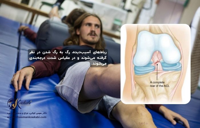 پارگی رباط صلیبی قدامی (ACL) زانو پارگی رباط صلیبی زانو