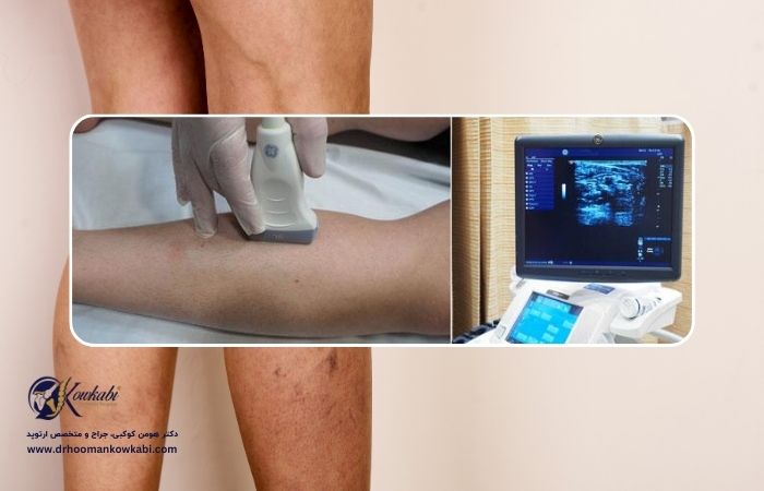 ترومبوز سیاهرگی عمقی (DVT): علل، علائم و راههای پیشگیری و درمان ترومبوز سیاهرگی عمقی