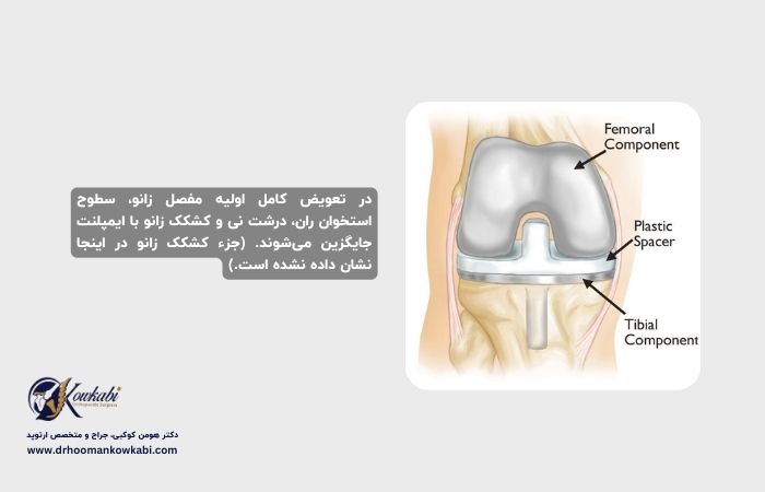 جراحی مجدد تعویض مفصل زانو
