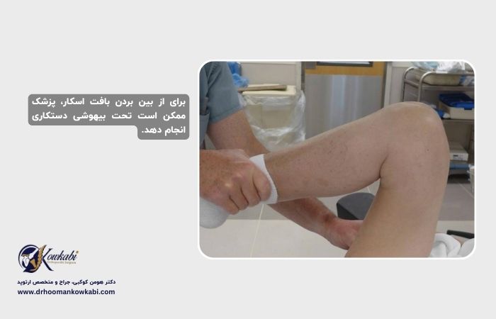 جراحی مجدد تعویض مفصل زانو