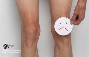 آرتروسکوپی زانو آزگود شلاتر