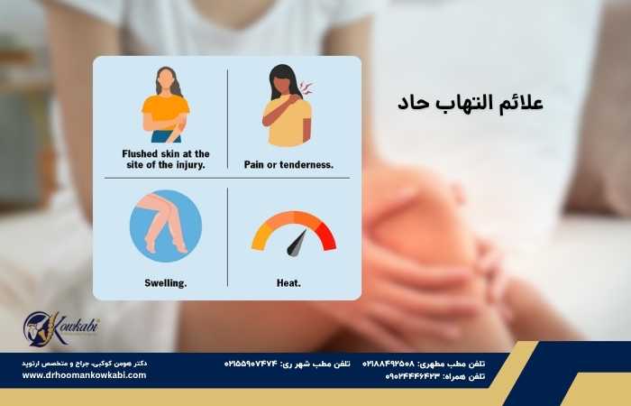 التهاب حاد