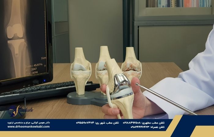 ایمپلنت‌های تعویض زانو