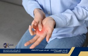 انگشت ماشهای