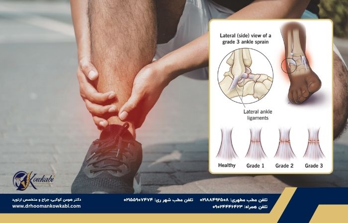 پیچ خوردگی