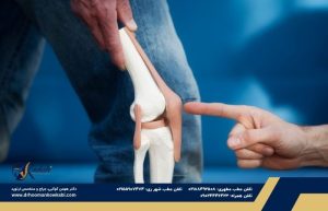 کندرومالاسی کشکک زانو
