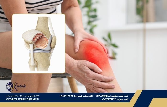 آرتروز پاتلوفمورال