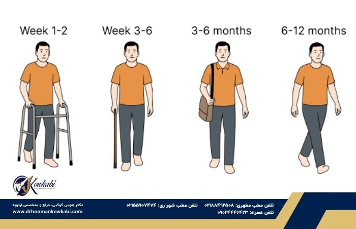 راه رفتن بعد از تعویض مفصل زانو راه رفتن بعد از تعویض مفصل زانو