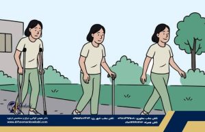 راه رفتن بعد از تعویض مفصل زانو